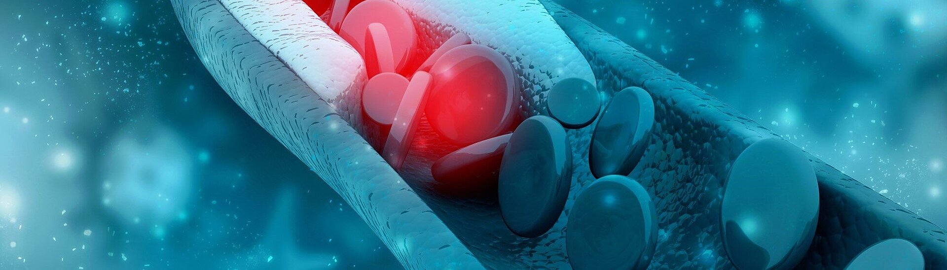 PI Ceramic - Kardiovaskuläre Eingriffe